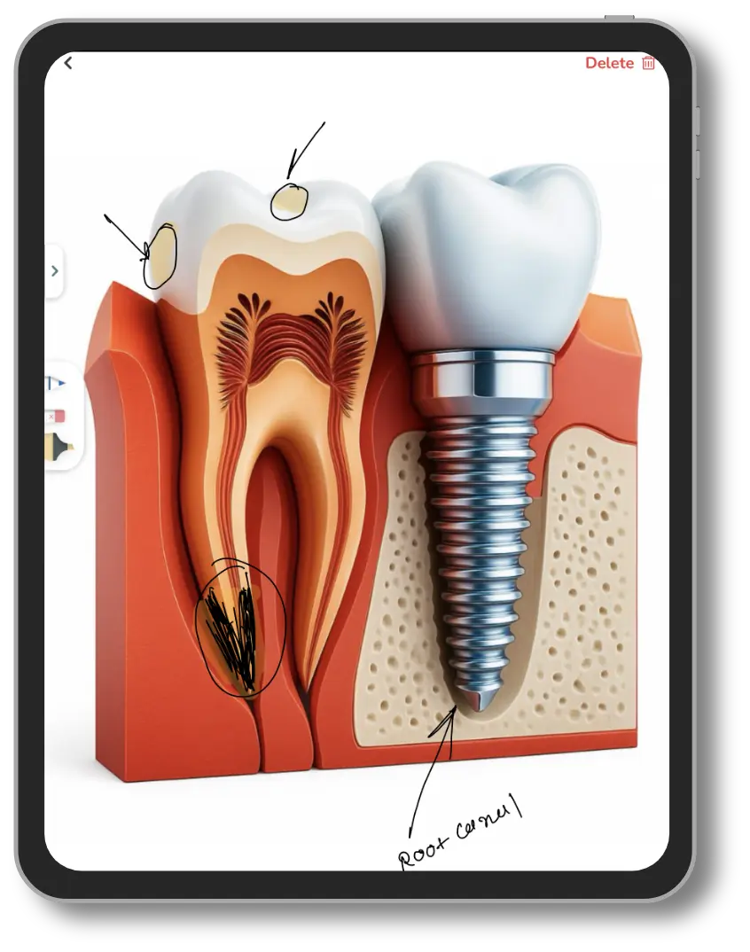 Patient education on Lifemaan tablet